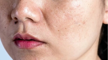 3 Rekomendasi Moisturizer Usia 40 Tahun Penghilang Flek Hitam, Gak Perlu Minder Lagi!