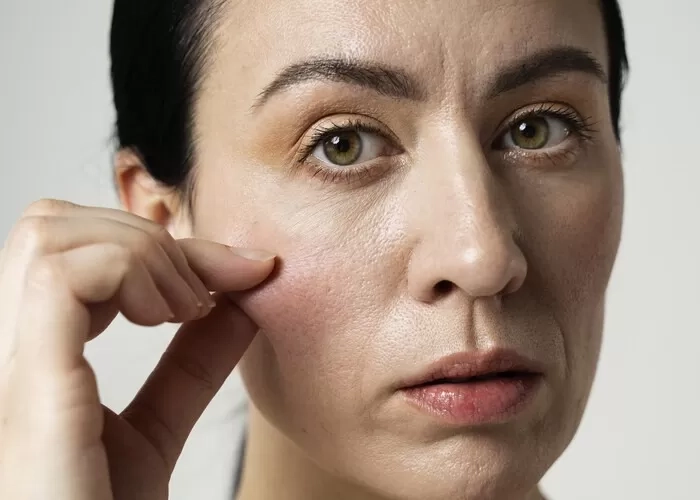 Benarkah Retinol Bikin Kulit Tipis? Dokter Jelaskan Cara Kerja, Mitos Pengelupasan, dan Tips Aman Penggunaan