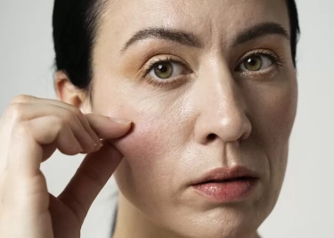 Benarkah Retinol Bikin Kulit Tipis? Dokter Jelaskan Cara Kerja, Mitos Pengelupasan, dan Tips Aman Penggunaan
