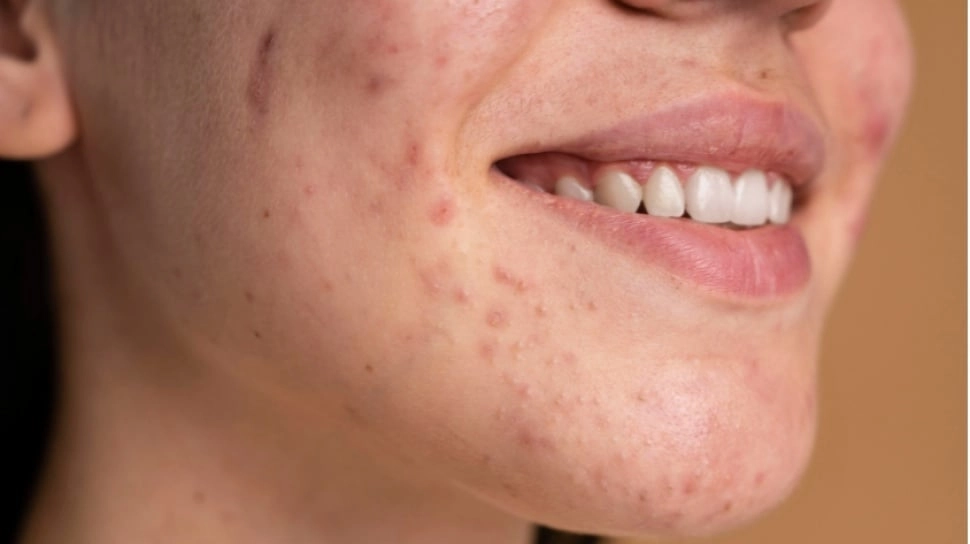 7 Produk Skincare Terbaik agar Wajah Tidak Gradakan di Usia Matang