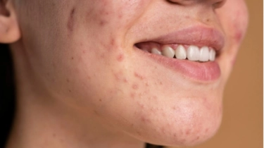 7 Produk Skincare Terbaik agar Wajah Tidak Gradakan di Usia Matang
