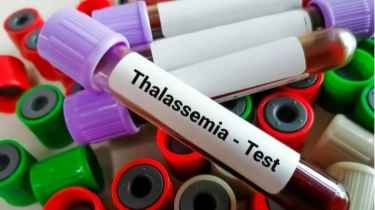 Perawatan Komprehensif untuk Thalasemia: Dari Transfusi hingga Dukungan Psikologis