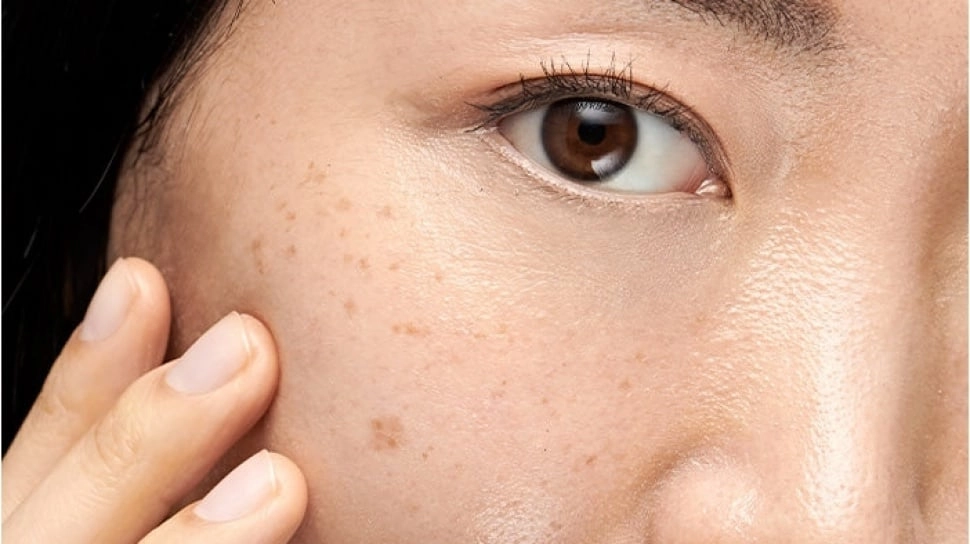Tak Cuma Produk Skincare, 5 Bahan Alami Ini Juga Ampuh Hilangkan Flek Hitam di Wajah