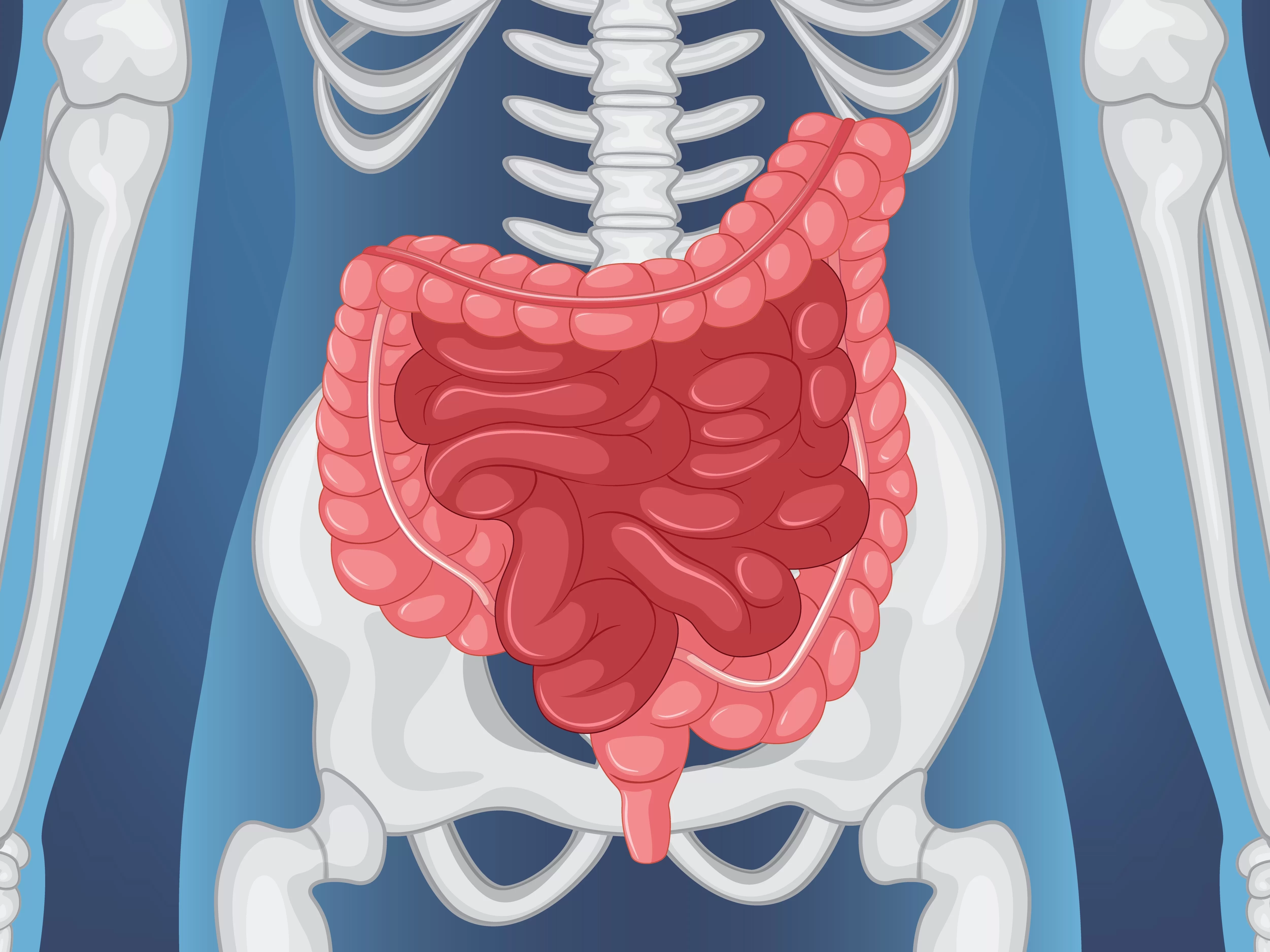 Apakah Benar Makanan Pedas Bisa Menyebabkan Usus Buntu? Ketahui tentang Definisi Penyakit Ini serta Gejalanya