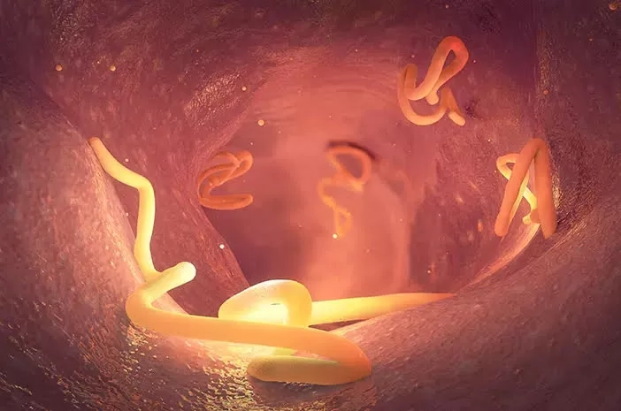 Jangan Anggap Sepele! Ini Dia Sejumlah Fakta Tentang Cacingan yang Harus Kamu Tahu!