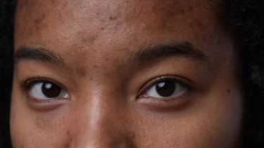 7 Sunscreen Mengandung Niacinamide untuk Mengurangi Flek Hitam, Semua di Bawah Rp60 Ribu