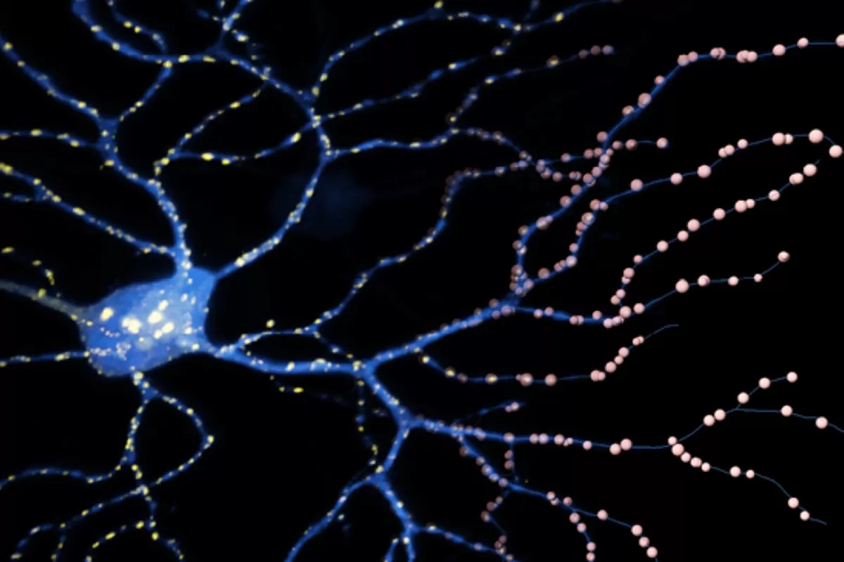 Kenali Sistem Glimfatik, Mekanisme Pembersih Otak yang Bisa Kurangi Risiko Demensia