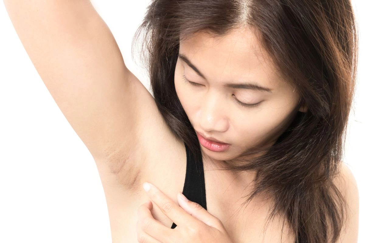 6 Cara Menghilangkan Bau Ketiak Menurut Dokter, Jaga Skin Barrier