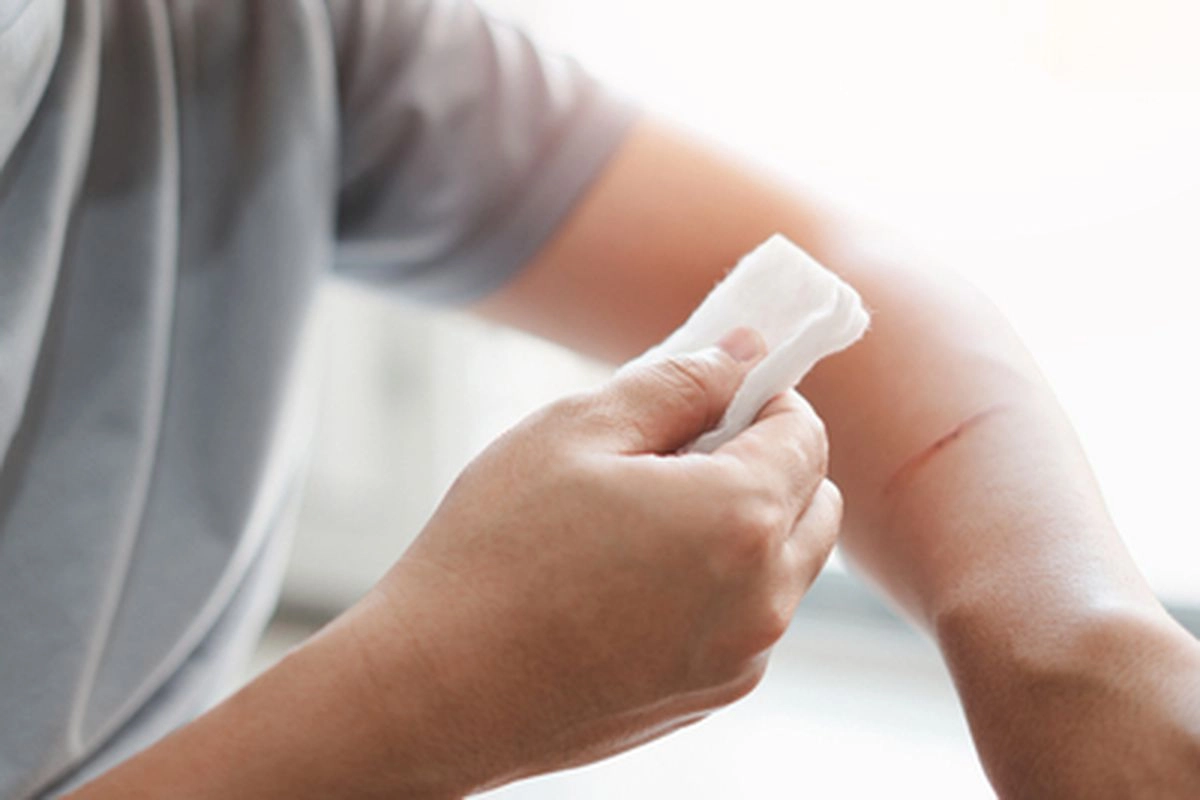 3 Cara Merawat Luka Ringan agar Cepat Sembuh Menurut Dokter