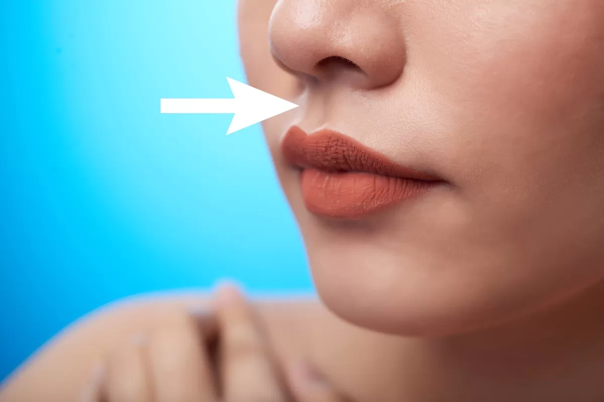 Ketahui Bagian Tubuh yang Bernama Filtrum, Apa Fungsinya terhadap Kesehatan dan Estetika?