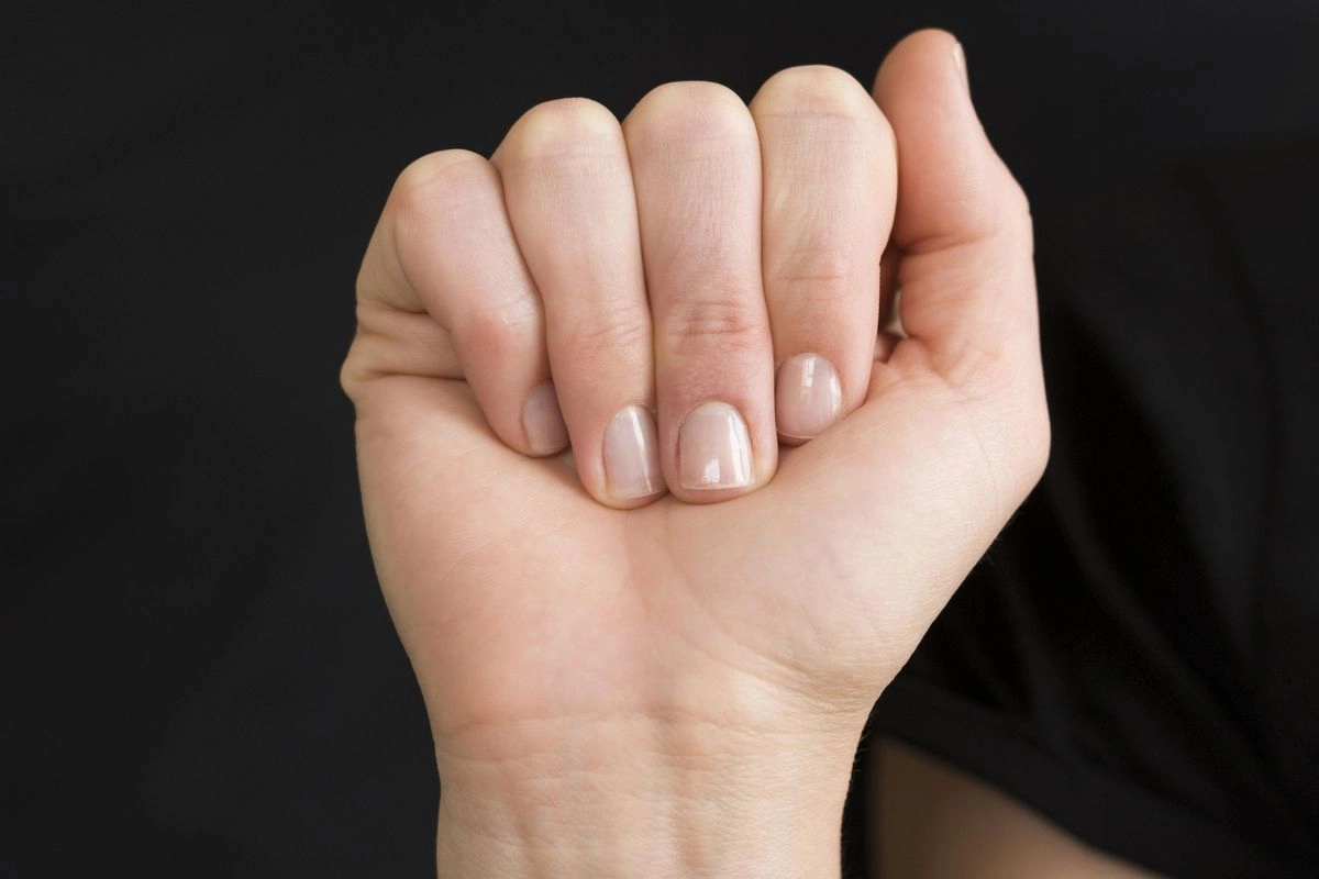 Perubahan Warna Kuku Tanda Masalah Kesehatan Tersembunyi
