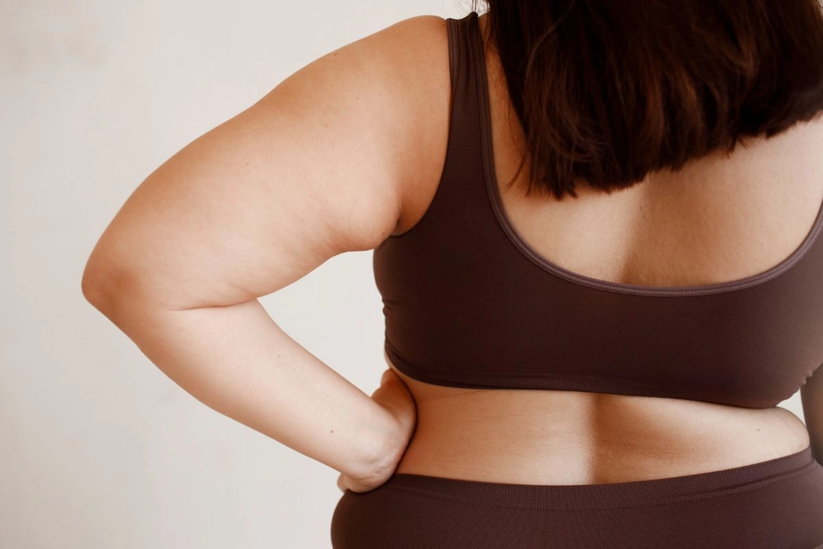 Generasi Baru Liposuction, Sedot Lemak Sekaligus Transfer Lemak