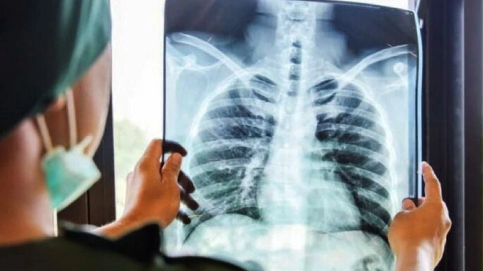 Tantangan Kompleks Bedah Bahu, RS Ini Hadirkan Pakar Dunia untuk Beri Solusi