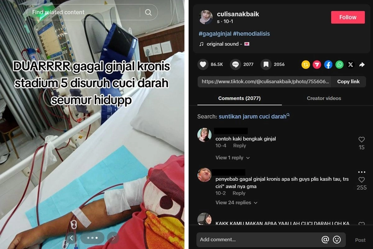 Kisah Sulistia: Dari Koma Dua Minggu hingga Menghadapi Gagal Ginjal Stadium 5