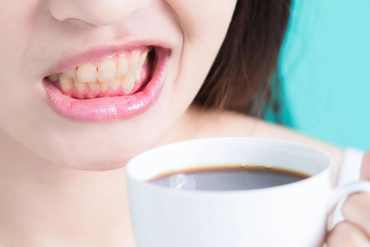 2 Kebiasaan yang Bisa Bikin Gigi Menguning