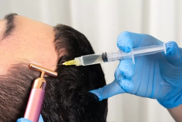 Tren Hair Treatment, Atasi Kerontokan Rambut dengan BioStimulator Treatment