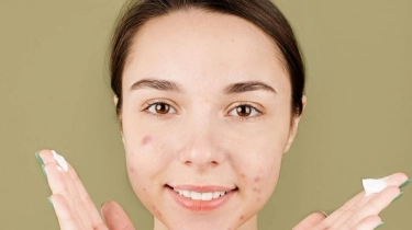 5 Rekomendasi Moisturizer Centella Asiatica untuk Kulit Sensitif dan Berjerawat