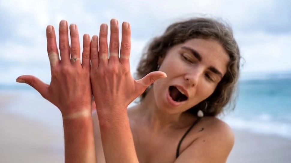 Cara Mengatasi Kulit Belang akibat Jalan-jalan Seharian saat Liburan, Bisa Pakai Bahan Alami