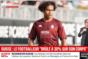 Pemain Klub Perancis Korban Tragedi Bar di Swiss, Luka Bakar 30 Persen