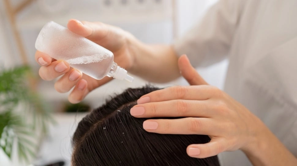 5 Hair Tonic untuk Menumbuhkan Rambut, Ampuh Atasi Kerontokan dan Kebotakan