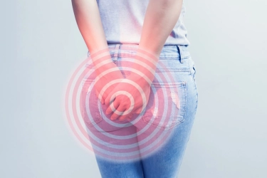 Ragam Pengobatan Wasir, Salah Satunya Metode Laser