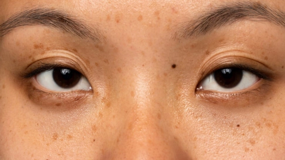 4 Skincare Flek Hitam di Bawah Rp100 Ribu yang Ampuh dan Aman BPOM, Hasilnya seperti Perawatan Mahal