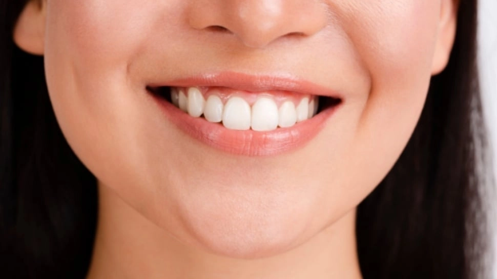 5 Pasta Gigi Pemutih untuk Putihkan Gigi Kuning