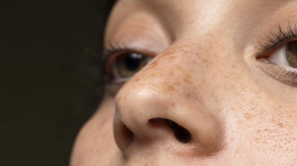 8 Kandungan Skincare yang Paling Cepat Menghilangkan Flek Hitam, dari Niacinamide hingga Retinol