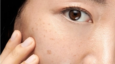 Cari Sabun Cuci Muka untuk Flek Hitam? Intip 6 Rekomendasinya yang Bikin Wajah Bersih Tanpa Noda