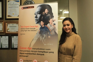 Cacar Api Bisa Terjadi di Usia Muda, Ini Cerita Keluarga Maia Estianty