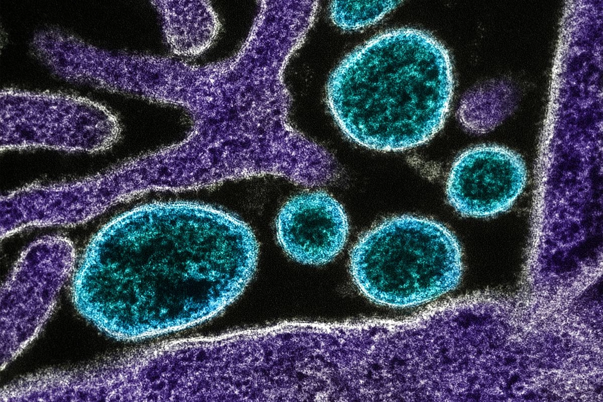 Kasus Virus Nipah Bertambah, Thailand Awasi Ketat Pendatang dari India