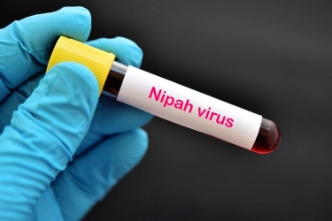 Virus Nipah Kembali Merebak di India, Ini Gejala dan Cara Penularannya