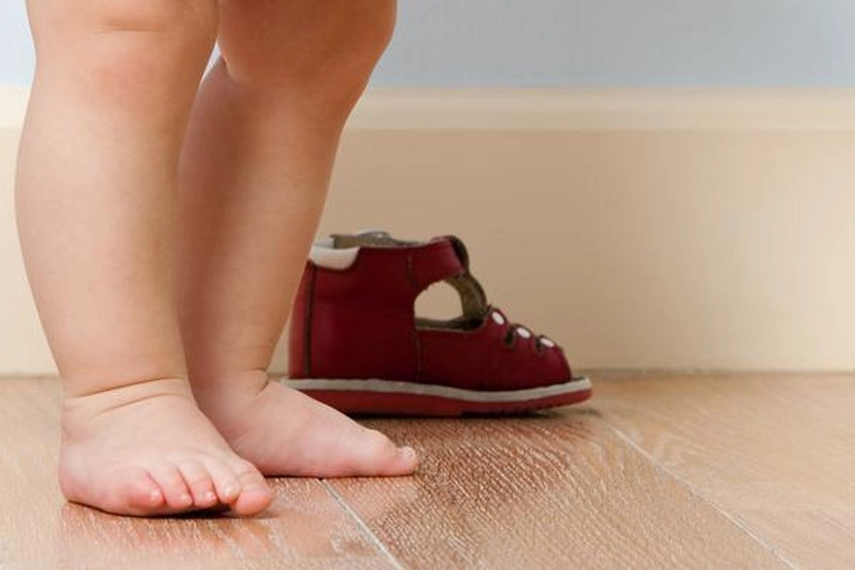 Kaki X dan O pada Anak, Normal atau Perlu Diperiksa Dokter?