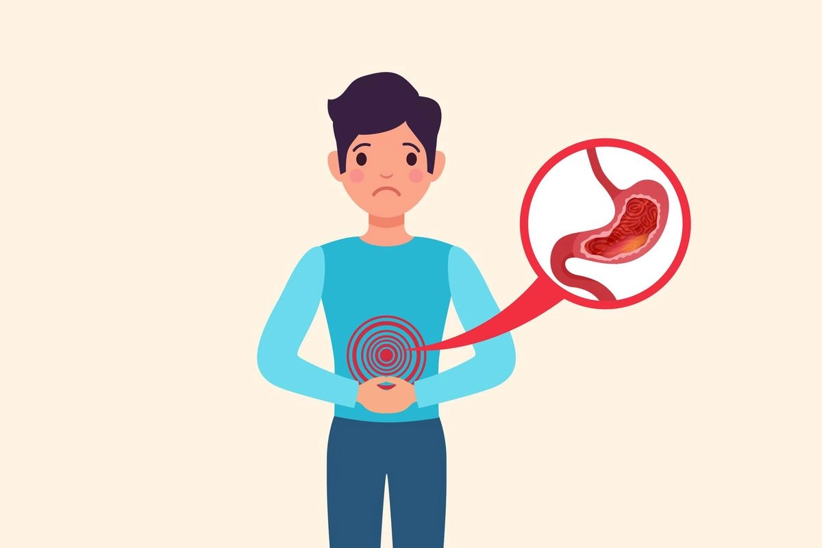 GERD Ramai Dibicarakan, Dokter Tegaskan Tak Sebabkan Kematian Mendadak