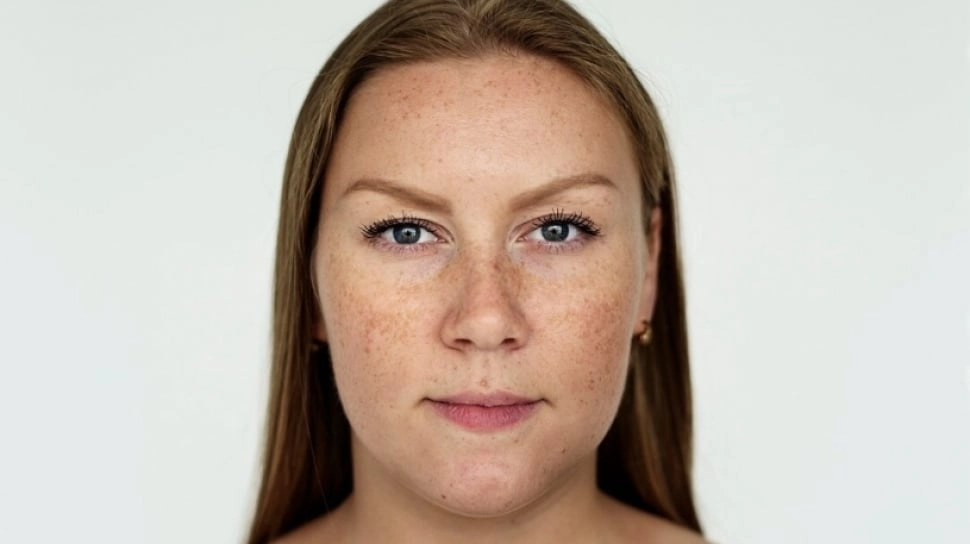 Mandelic Acid vs Lactic Acid, Mana yang Lebih Aman untuk Lansia Hilangkan Flek Hitam?