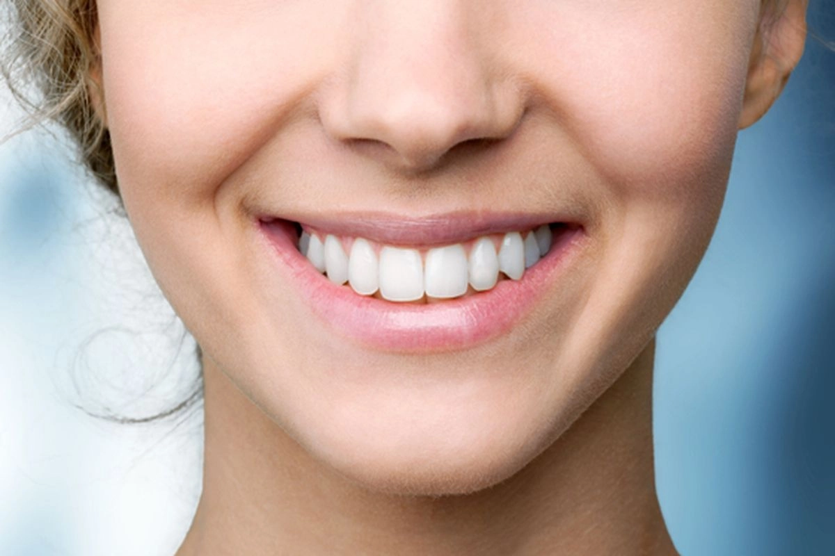 Aligner Transparan jadi Pilihan Populer Merapikan Gigi Tanpa Kawat