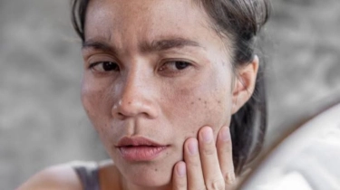 4 Skincare Lacoco untuk Hempaskan Noda Hitam, Brand Lokal Rasa Premium