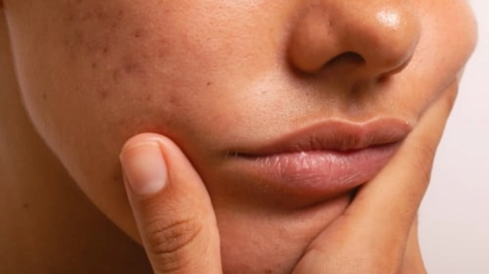 5 Moisturizer Alternatif Cerave untuk Atasi Skin Barrier Rusak, Kulit OTW Mulus Kembali