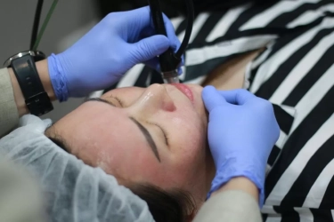 Kulit Tropis Lebih Rentan Flek? Ini Penjelasan Dokter soal Hiperpigmentasi dan Cara Menanganinya