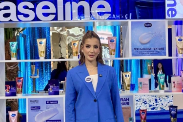 Cerita Tasya Farasya Alami Kulit Kering sampai Bersisik