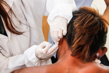 Bercak Putih Mati Rasa Bisa Jadi Gejala Kusta, Ini Penjelasan Dokter