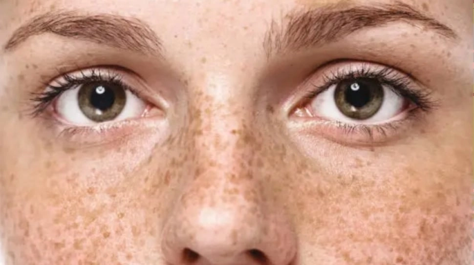 5 Pilihan Sunscreen Azarine Terbaik untuk Flek Hitam di Wajah