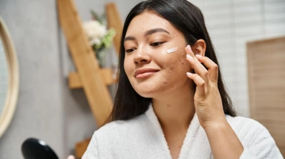 Moisturizer Apa yang Cocok untuk Kulit Berjerawat? Ini 5 Pilihannya
