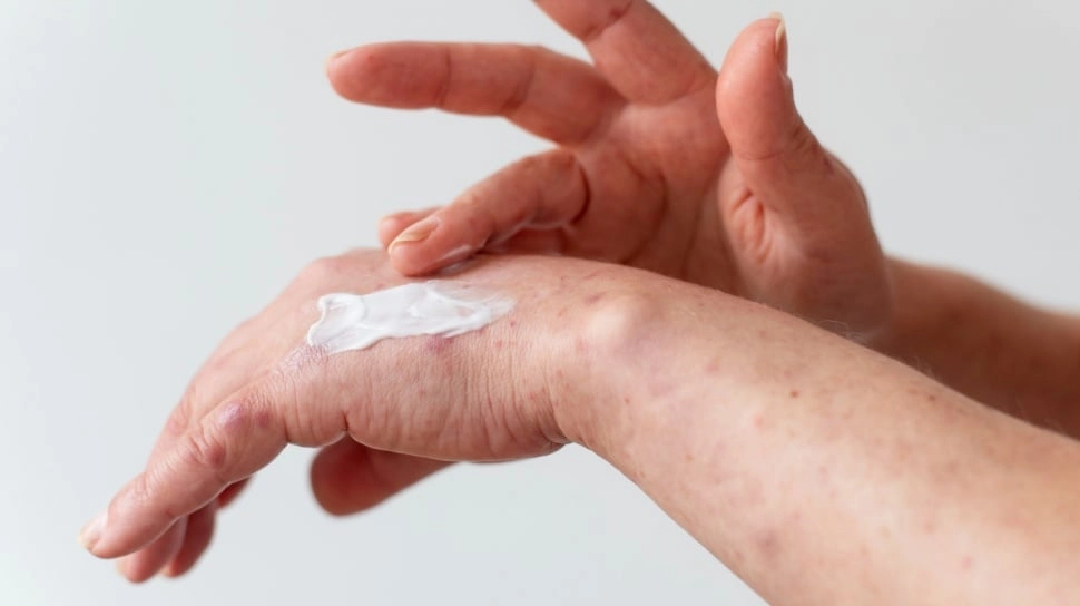 5 Rekomendasi Lotion dengan Kolagen agar Kulit Tetap Kencang dan Terawat