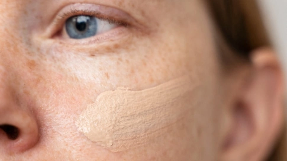 Apa Bedanya Melasma dan Flek Hitam? Ini 4 Sunscreen yang Efektif Menyamarkan