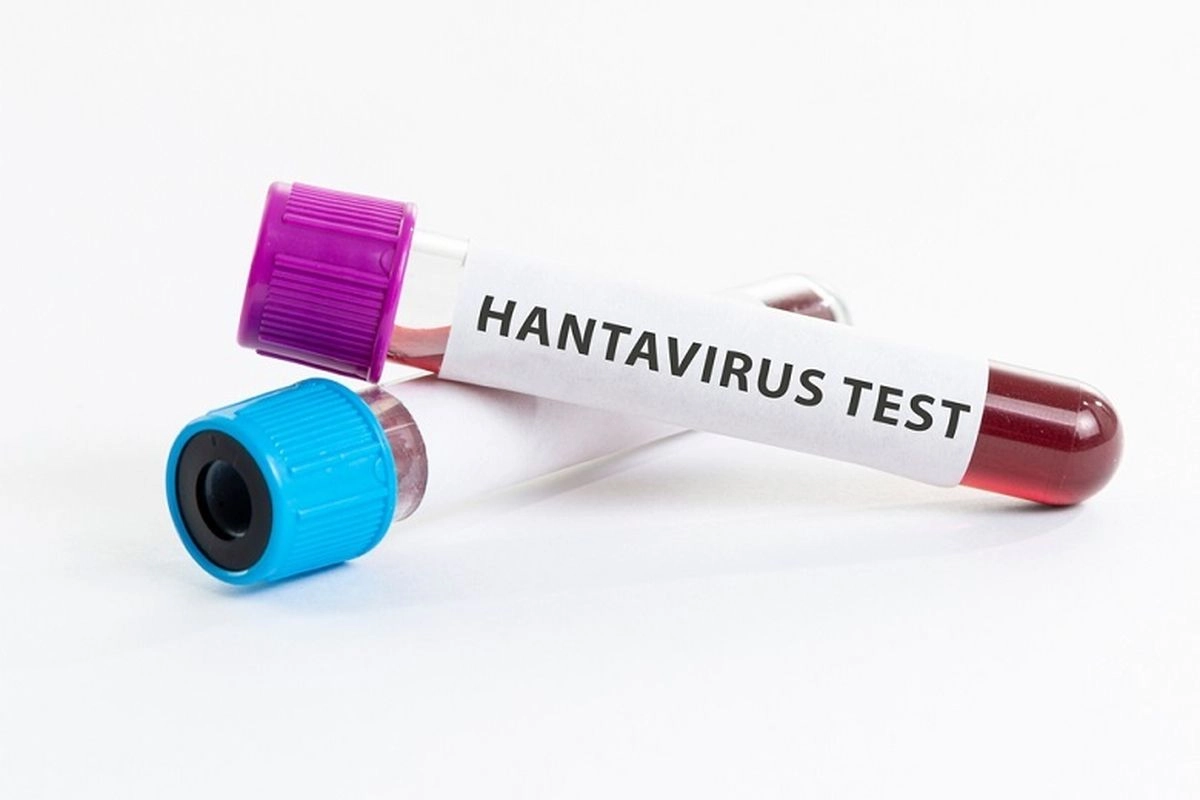 Kemenkes soal Hantavirus: Masyarakat Tidak Perlu Panik, tapi Tetap Harus Waspada