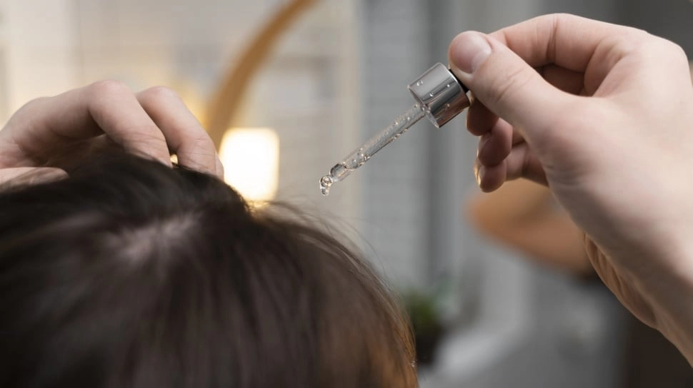 5 Serum Penumbuh Rambut Terbaik untuk Rambut Menipis dan Area Botak